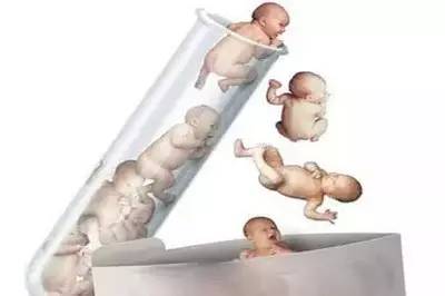 取卵手术室